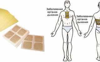 Горчичники: способы применения, действие, показания и противопоказания