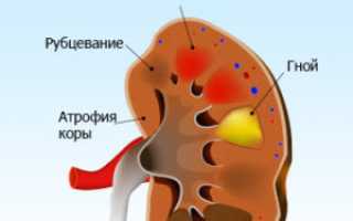 Чем отличается Фурамаг от Фрагина: какой препарат лучше