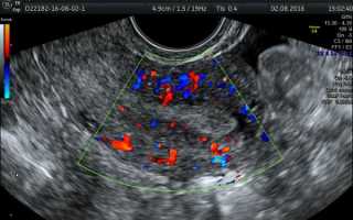 Для чего делают допплерометрию сосудов матки, кому ее назначают и как расшифровать результаты