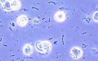 Что означают много бактерий в моче у ребенка: причины появления в анализе урины
