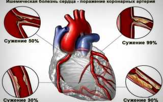 Что покажет УЗИ сердца: правильная подготовка, виды, показания и проведение