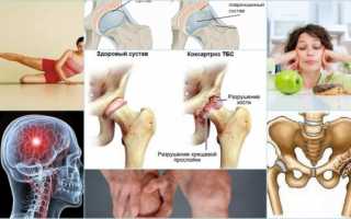 Чем и как лечить косартроз тазобедренного сустава