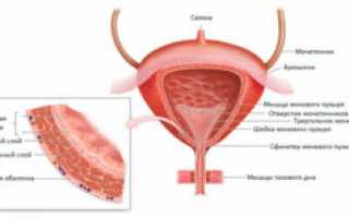 Причины и лечение уплотнения стенок мочевого пузыря