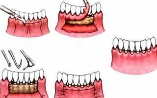 Кто такой врач стоматолог-пародонтолог, что он делает, особенности лечения у пародонтолога