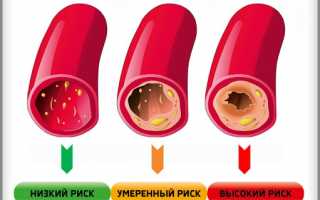 Повышенный холестирин: причины, симптомы, лечение