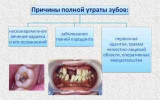 Возможные варианты протезирования при полном отсутствии зубов