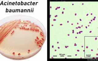 Acinetobacter: характеристика, патогенность, симптоматика, диагностика, лечение