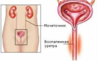 Что означает слизь в моче у ребенка: причины возникновения