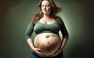 Как растет живот при беременности: ощущения, форма живота