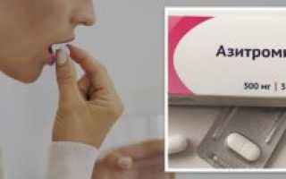 Эффективное лечение цистита препаратом Азитромицин