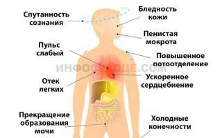 Почему возникает постинфарктный кардиосклероз и можно ли его вылечить?