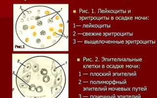 Какие анализы мочи существуют – виды исследований, нормы