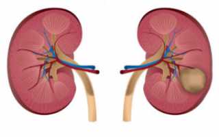 Последствия и опасность образования кисты на почке