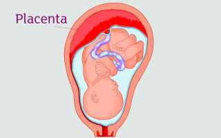 Гиперплазия плаценты