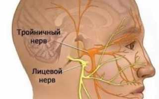 Неврит лицевого нерва: причины, симптомы и лечение