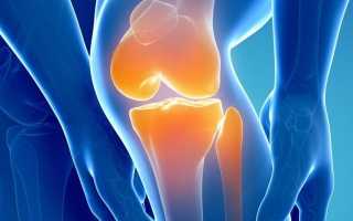 Что такое артроз коленного сустава 2 степени и как его лечить?