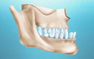Щелкает и хрустит челюсть при открытии рта и жевании: причины и что делать