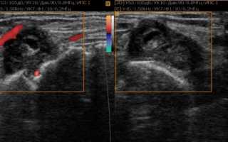 Что покажет УЗИ голеностопного сустава, как его проводят и когда назначают