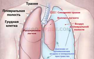 Почему при вдохе колит в области сердца и что делать?