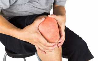 Симптоматика и лечение болезней коленного сустава