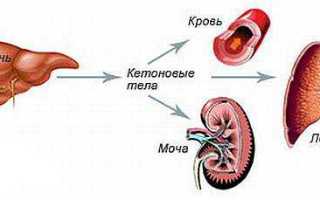 Ацетон у ребенка — страшный сон для родителей