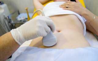 Как делают у женщин УЗИ яичников: показания, подготовка, результаты, стоимость