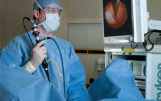 Установка и удаление стента в мочеточнике: показание к операции, осложнения
