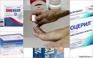 Обзор противогрибковых лаков для ногтей — описание препаратов, отзывы