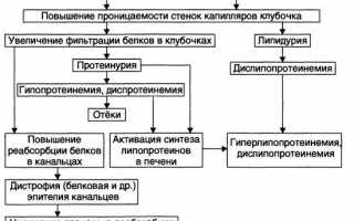 Причины возникновения нефротического синдрома у детей: диагностика и лечение