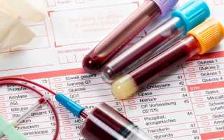 Анализ крови на ХГЧ и ТТГ