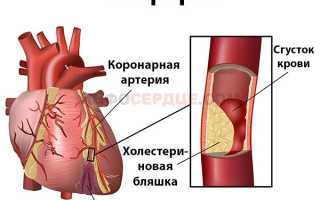 Какие патологии могут провоцировать жжение в области сердца?