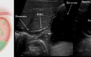 Как делают УЗИ пищевода, что оно показывает в норме и при болезни