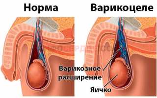 Что такое проба и прием Вальсальвы и для чего они используются?