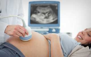 Что такое ЭхоКГ сердца плода: как, когда и зачем ее делают при беременности