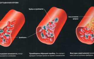 Почему бывает плохая свертываемость крови и что с этим делать?