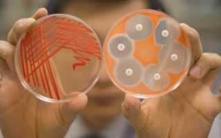 Serratia: патогенность, диагностика, симптомы, лечение и профилактика