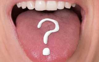 Заболевания полости рта и языка: виды патологий и способы их лечения