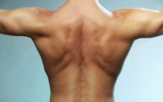 Аллергические высыпания на спине
