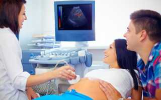 Что такое экспертное УЗИ и зачем его назначают при беременности и заболеваниях