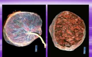 Размеры плаценты: особенности формирования, строения, функций и изменений в процессе беременности
