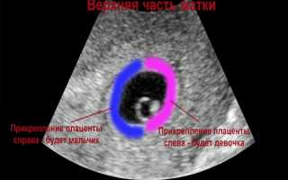 Когда точно определяется на УЗИ пол ребенка и может ли врач ошибиться