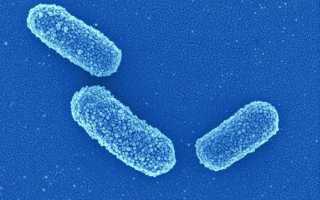 Klebsiella spp в моче – что это значит?