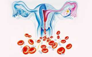 Маточное кровотечение