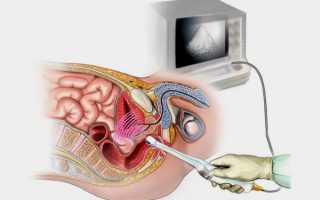 Как делают УЗИ заднего прохода (прямой кишки): показания, проведение, результаты, цена