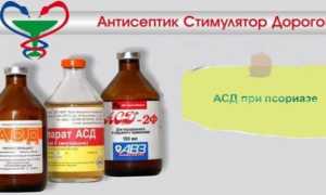 АСД фракция при псориазе