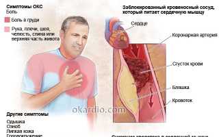 Симптомы острой коронарной недостаточности и прогноз жизни