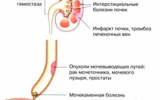 От чего возникает у мужчин моча красного цвета