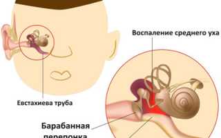 Продуло ухо: выявление, заболевания-последствия и их лечение