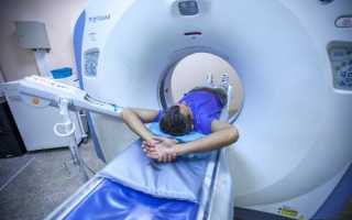Как и зачем проводится МРТ мягких тканей и сосудов шеи