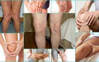 Симтоматика и лечение остеохондроза коленного сустава